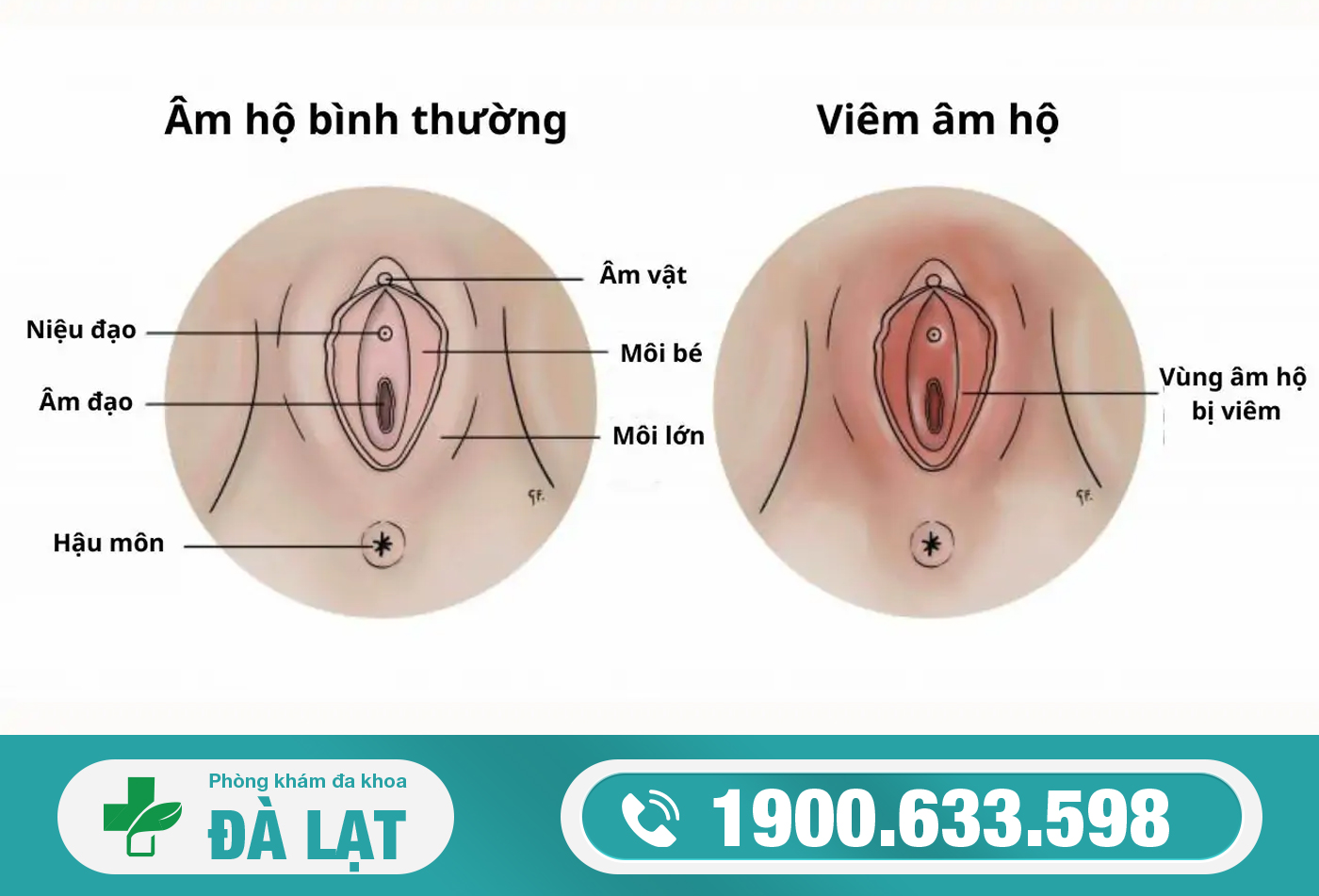 Hình ảnh minh họa